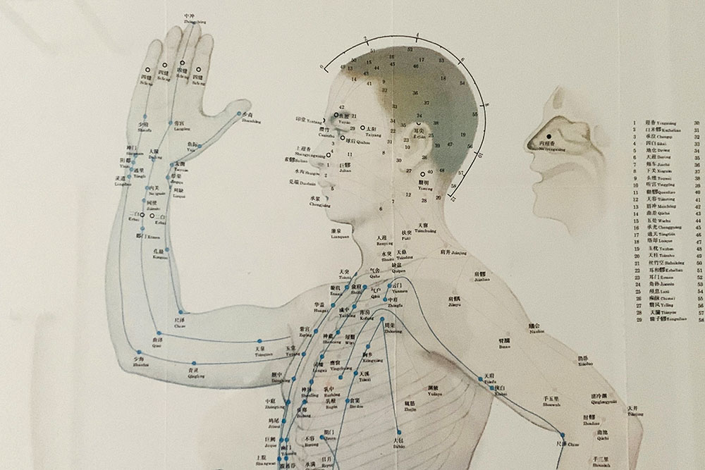 Plakat mit Abbildung eines Mannes und der eingezeichneten Akupunkturpunkte