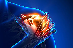 akuter-schulterschmerz-grafik-310x207