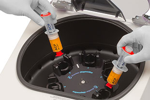 Zentrifuge für die Stammzellentherapie