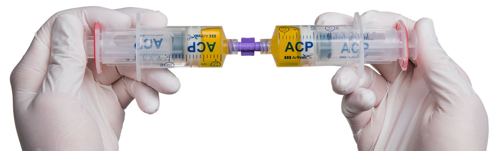 Zwei Hände mit zwei Spritzen, die miteinander verbunden sind